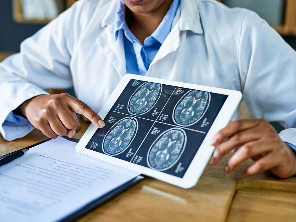 Discussing A Brain Scan — Sterling Heights, MI — Intracare Surgery Center