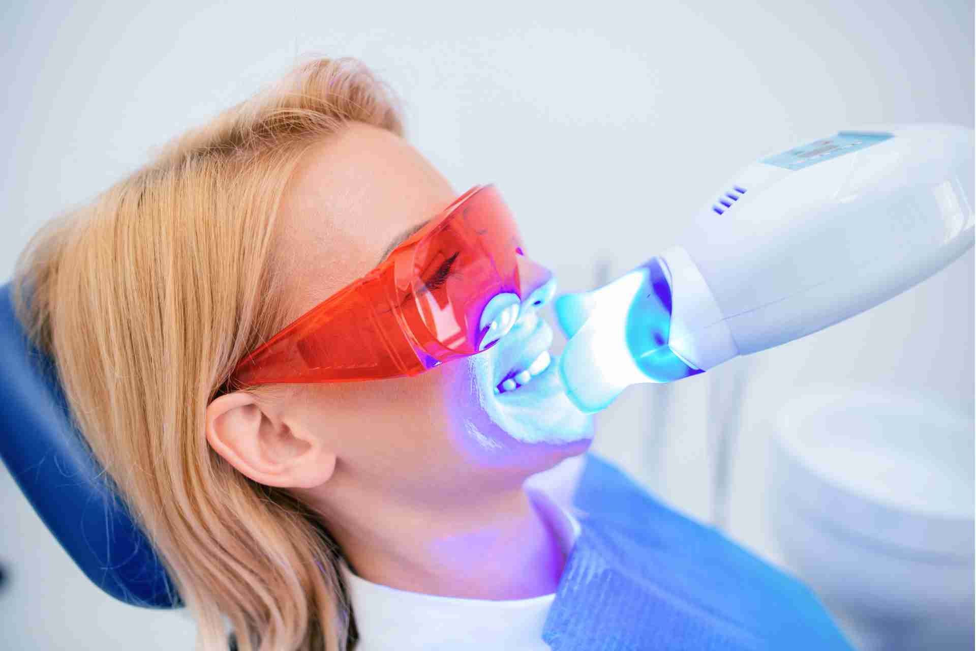 Does Teeth whitening work
