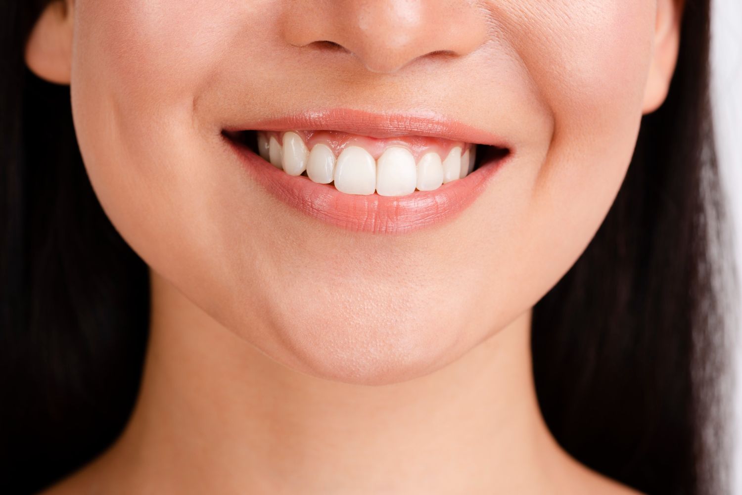 retainers vs braces filling gaps between teeth