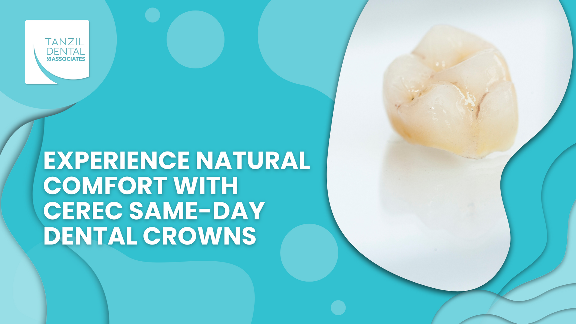 A close up of a dental crown on a blue background.