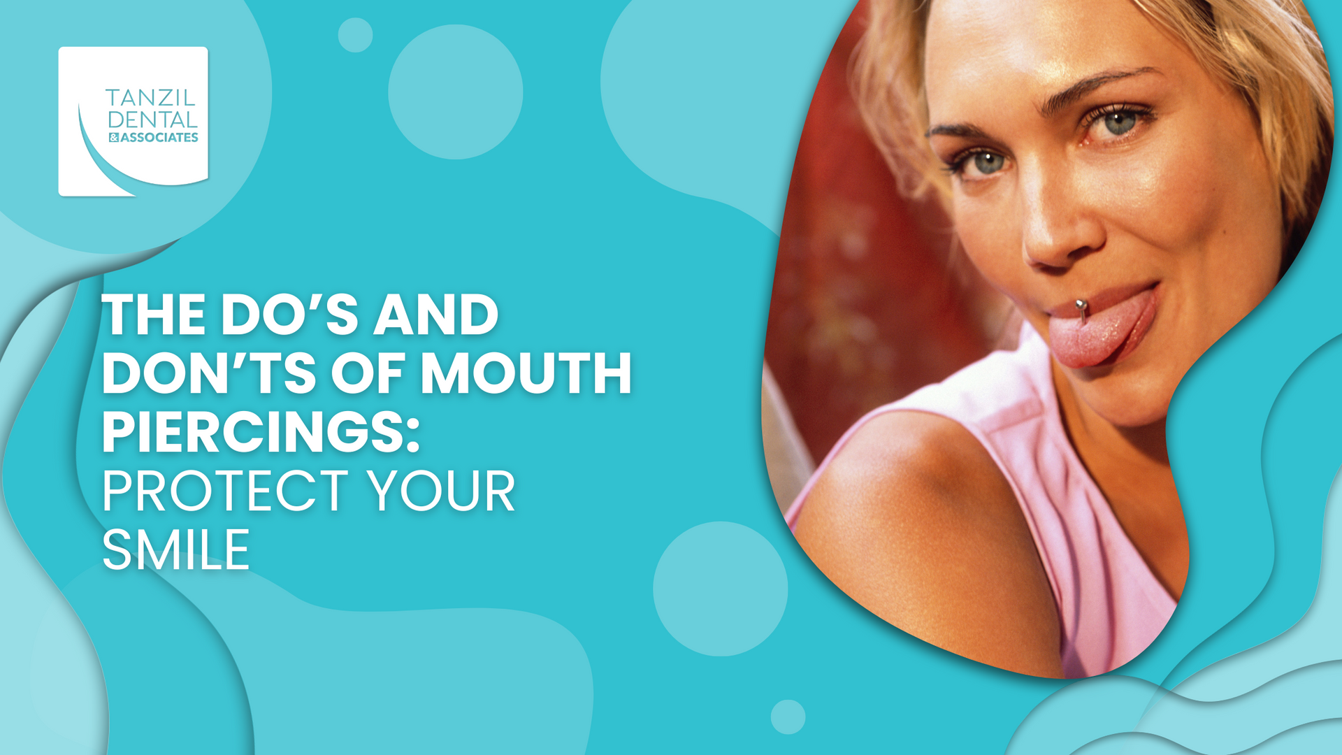The do 's and don 'ts of mouth piercings : protect your smile