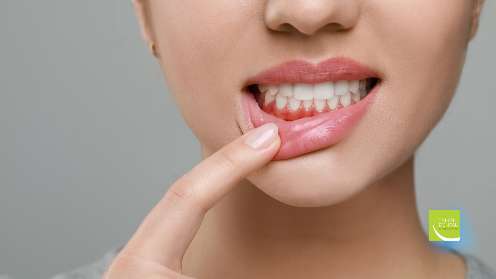 A woman is pointing at her teeth with her finger.