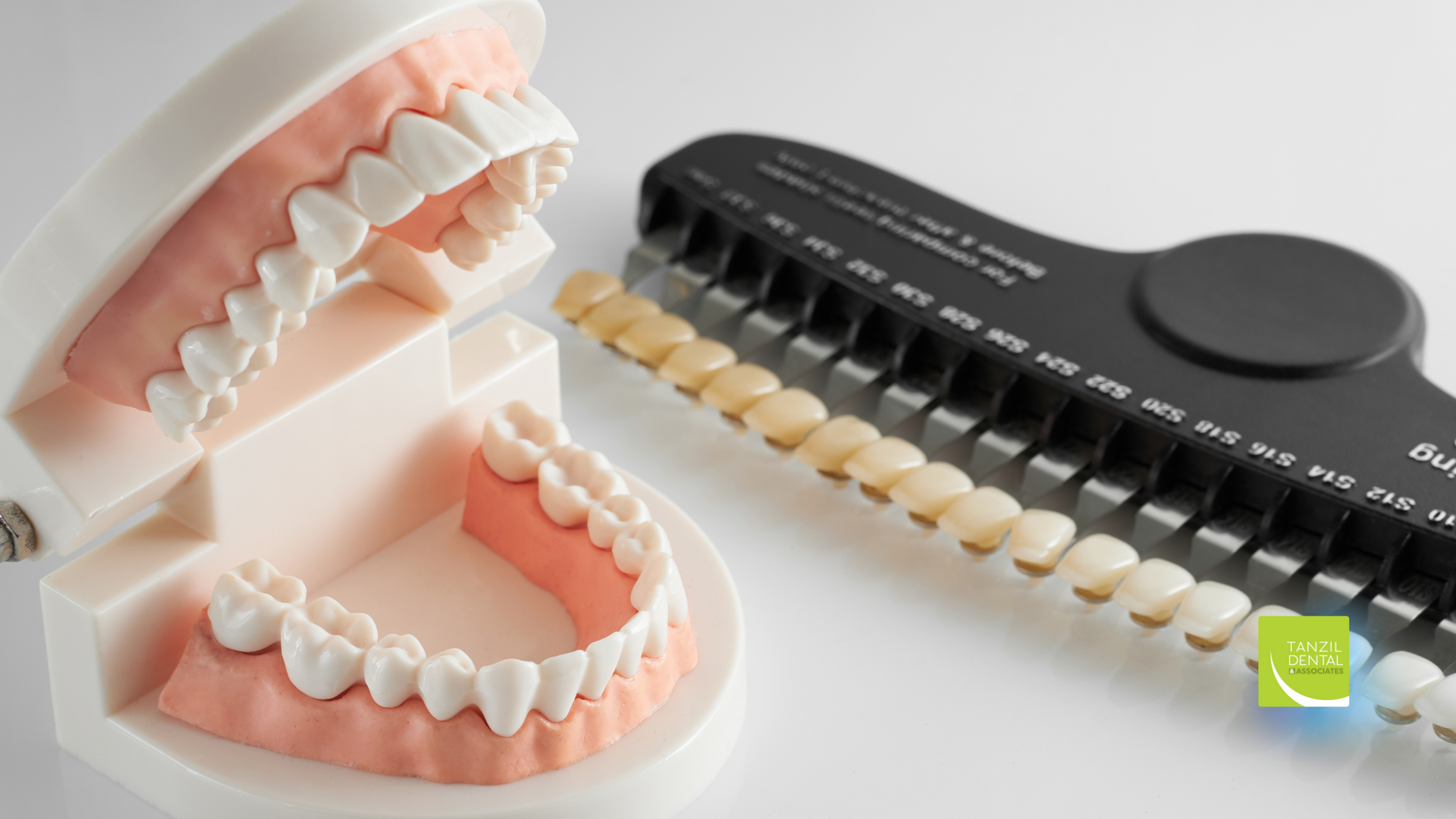 A model of teeth next to a tooth color chart.