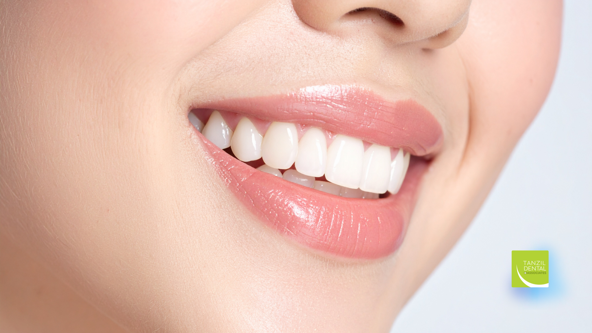 Smiling mouth with bright white teeth and glossy pink lips.