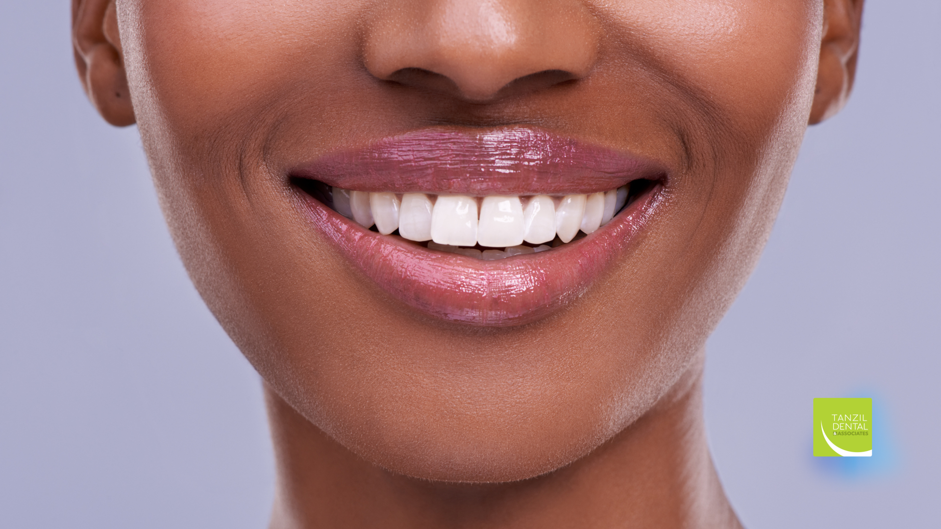 Close-up of smiling Black woman with white teeth and glossy pink lips against a neutral background.