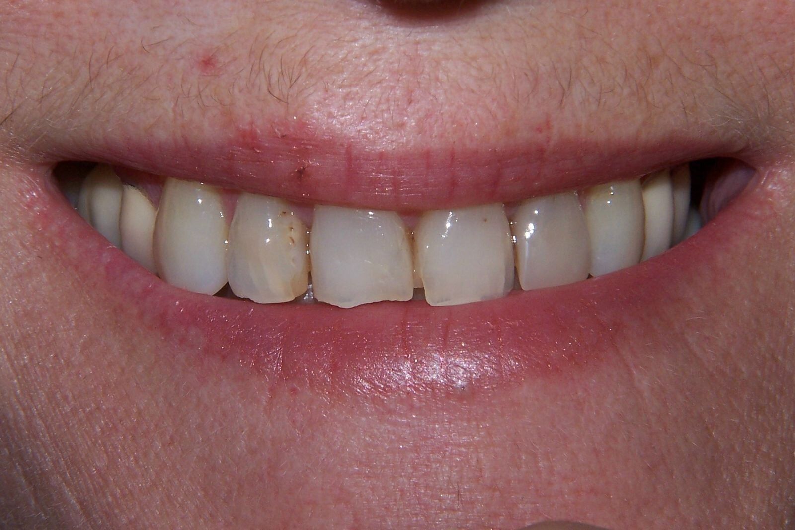A close up of a person 's mouth with white teeth