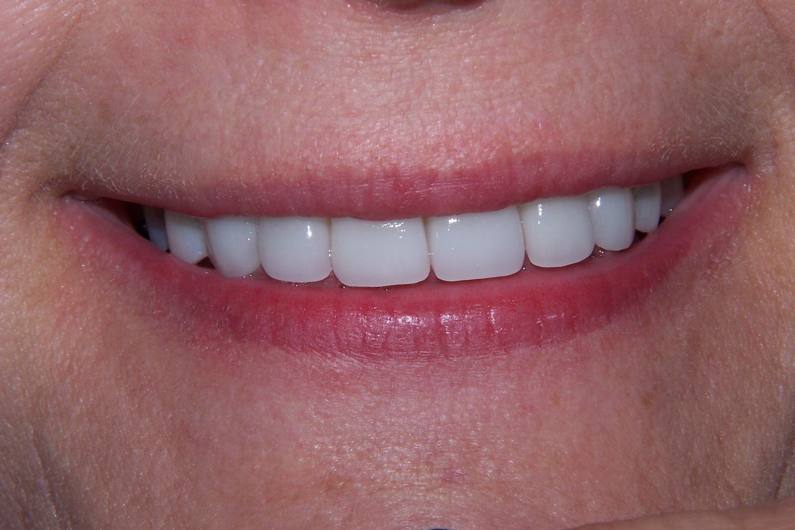 A close up of a woman 's smile with white teeth and red lips.