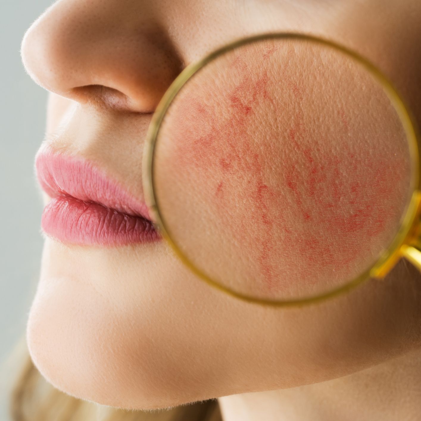 Chemical peels in Matawan, NJ at Source Medical Aesthetics