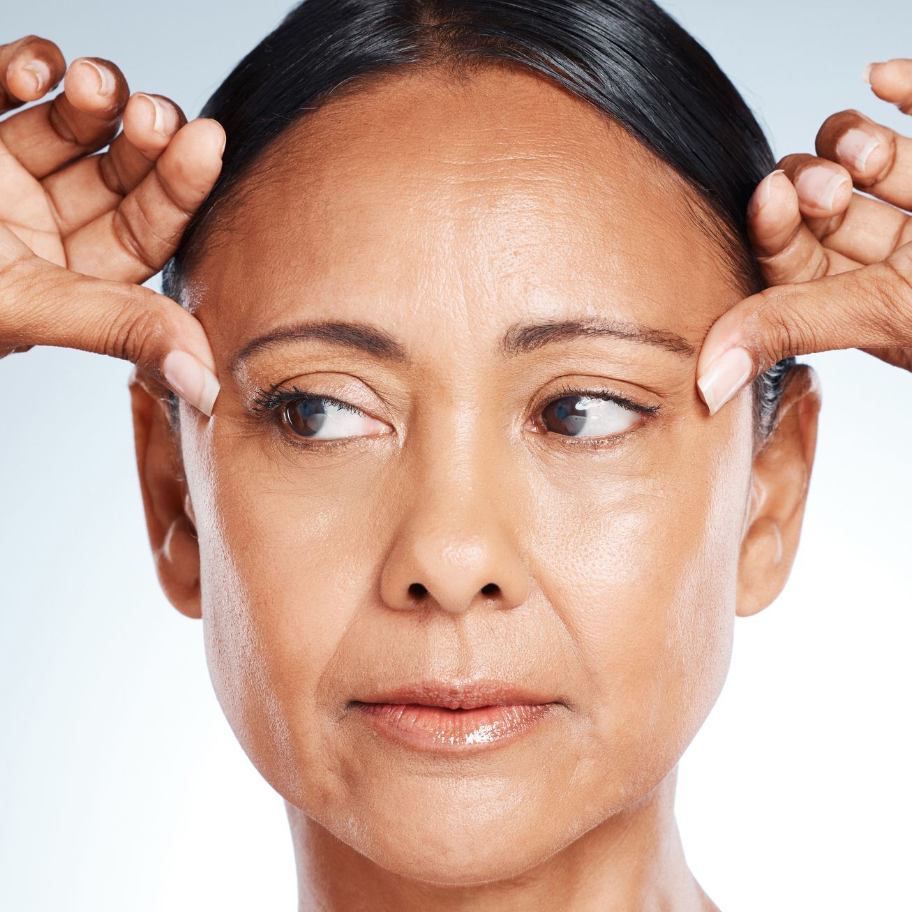 Rosacea treatments in Matawan, NJ