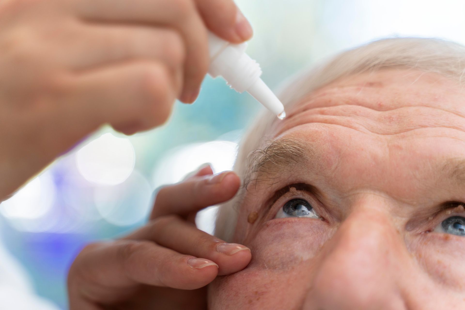 A person carefully administering eye drops into the eye of another individual.