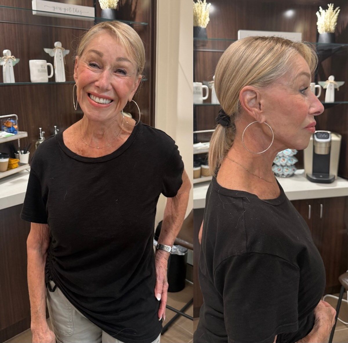 Woman in black shirt, blonde hair, smiling. Front and profile view, setting appears to be a medical office.