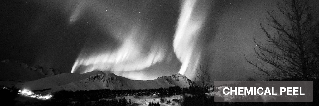 Black-and-white night sky with bright aurora over mountains and trees, with “CHEMICAL PEEL” text in the corner