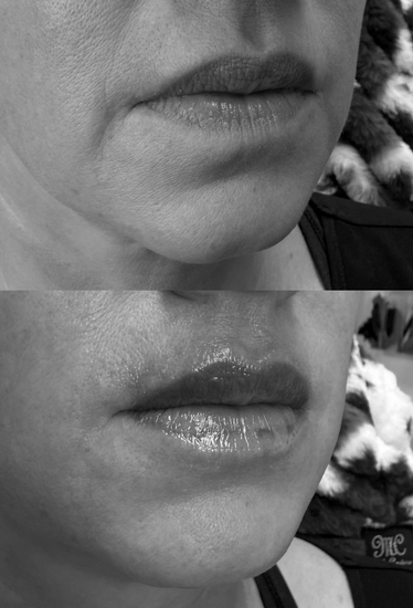 Close-up black-and-white before-and-after lips, with the lower lip glossy and shimmery