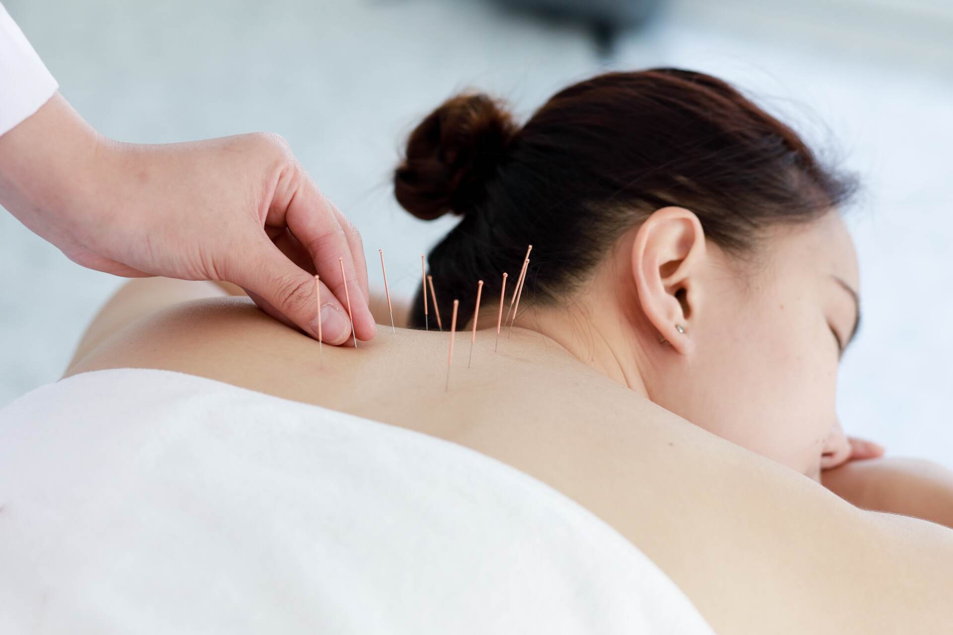 Frau nutzt Komplementärmedizin für die Needling-Therapie