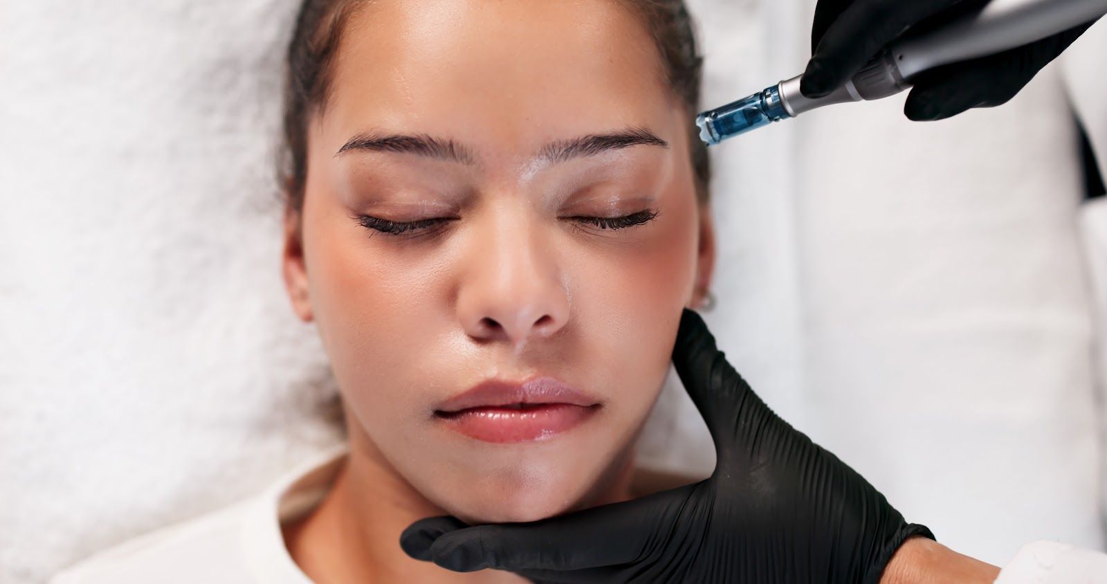 Cosmetic treatment being injected near a woman’s temple as she lies with eyes closed