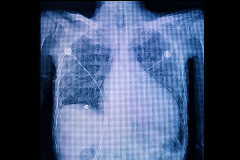 Cardiólogo Pediatra Dr. Luis Ángel Ayala Romero