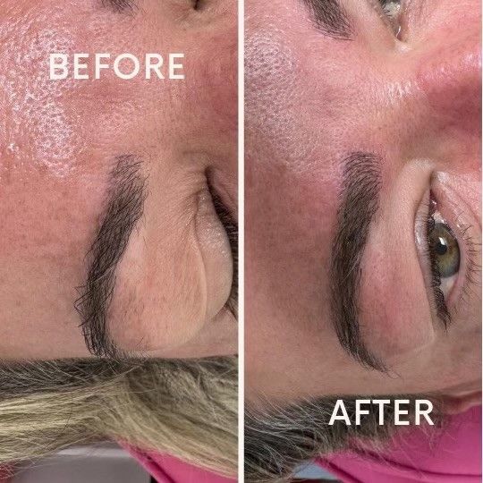 Comparison of a woman's face before and after an eyebrow procedure, showing fuller brows and smoother skin.