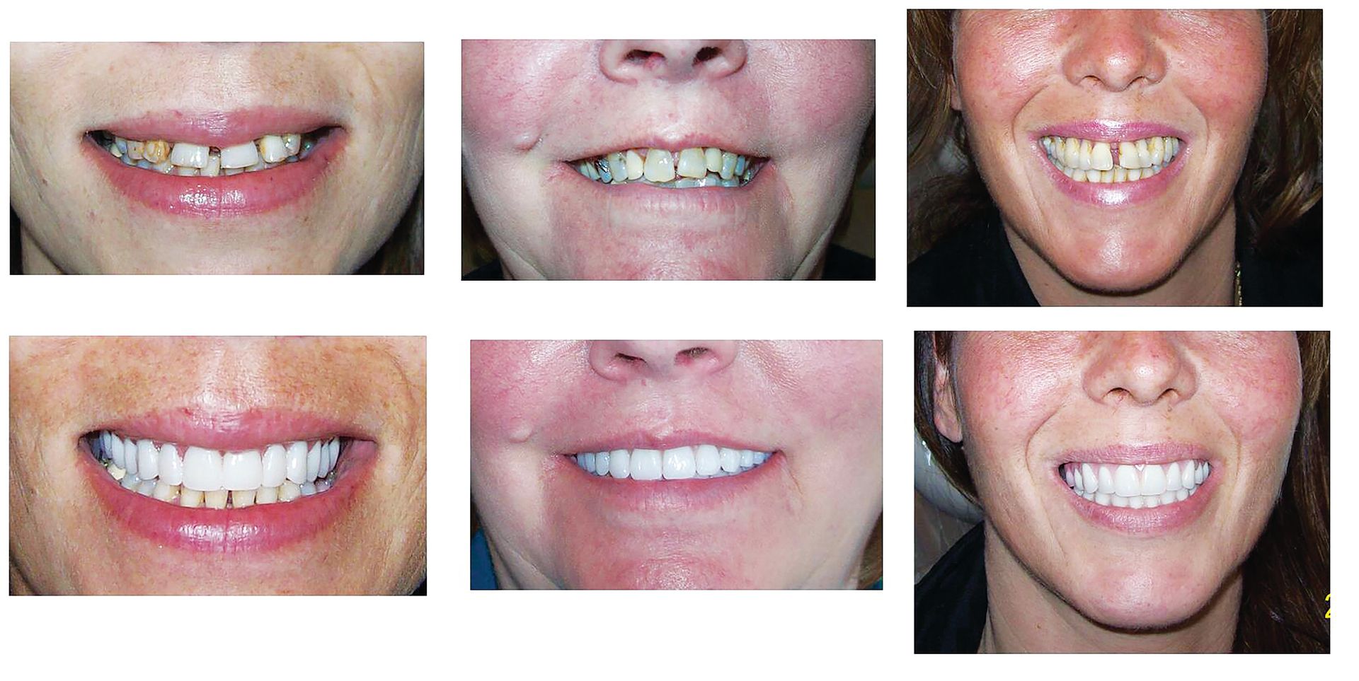 Three sets of before-and-after photos showing dental restoration and smile makeovers with improved tooth alignment.