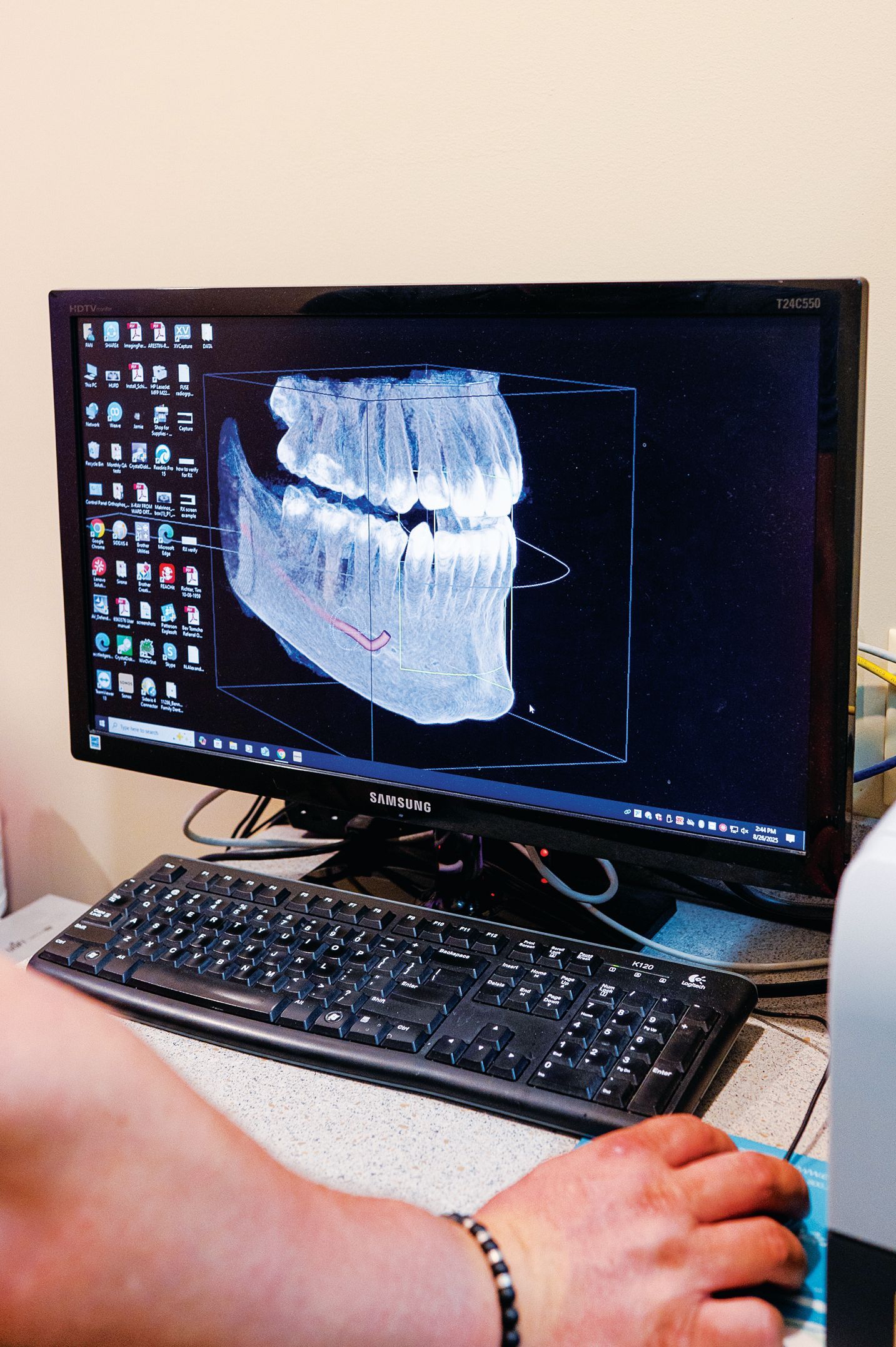 A person uses a computer mouse to view a 3D dental scan of a patient's jaw on a monitor.