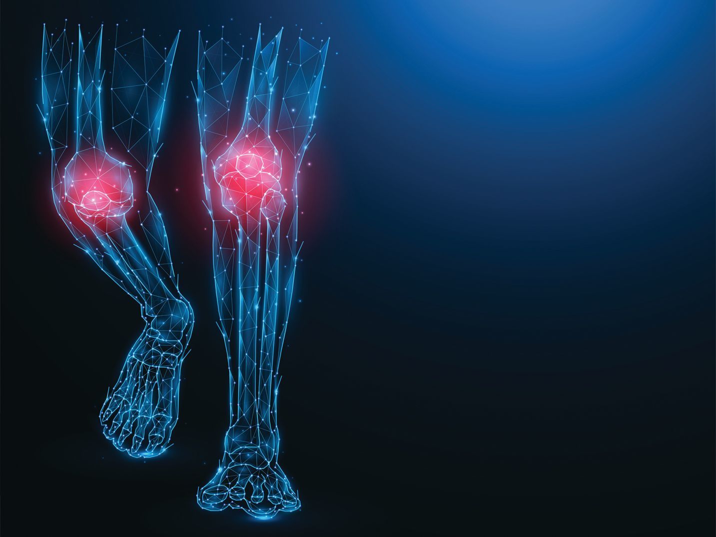 Digital wireframe illustration of human legs on a dark background, highlighting glowing red pain points at the knees.