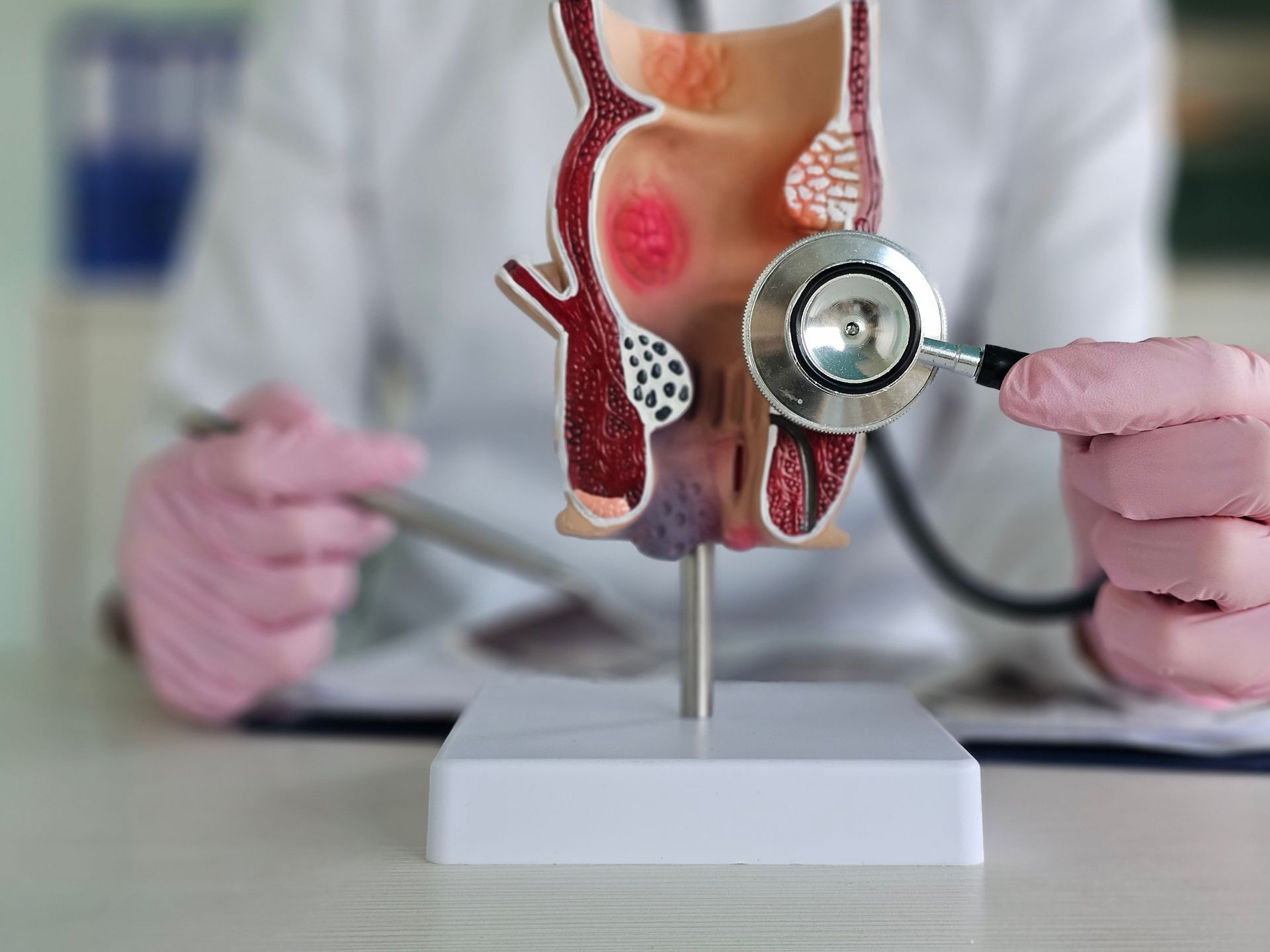 A person in gloves holds a stethoscope to an anatomical model of the human rectum showing various medical conditions.