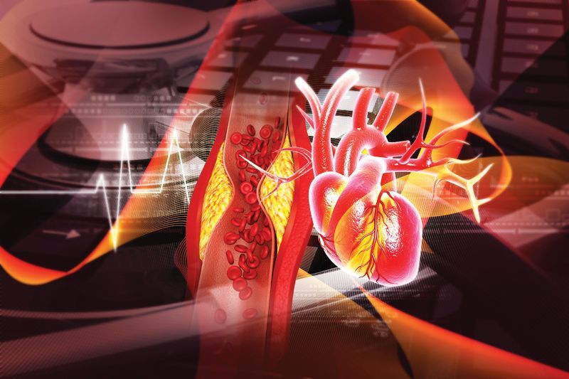 A 3D illustration shows a human heart and an artery with plaque buildup, overlaid with a heartbeat rhythm and data grids.
