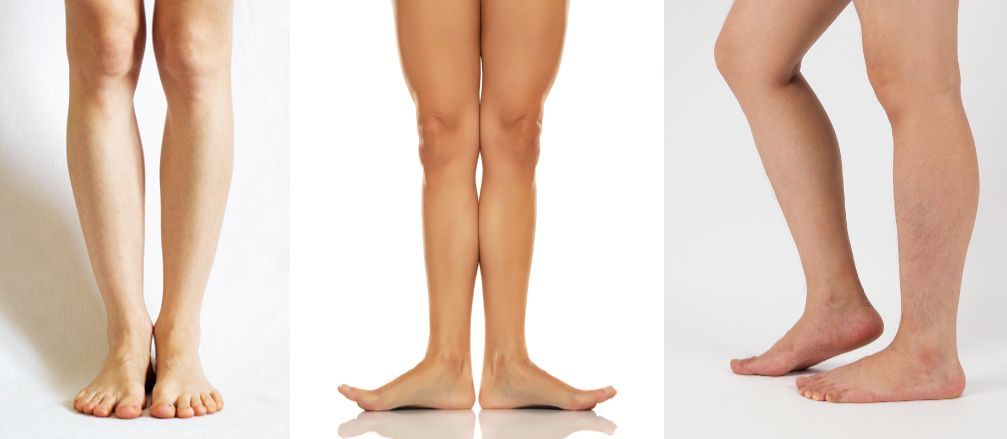 Three side-by-side views of bare human legs, shown from the front, back, and side against a plain white background.