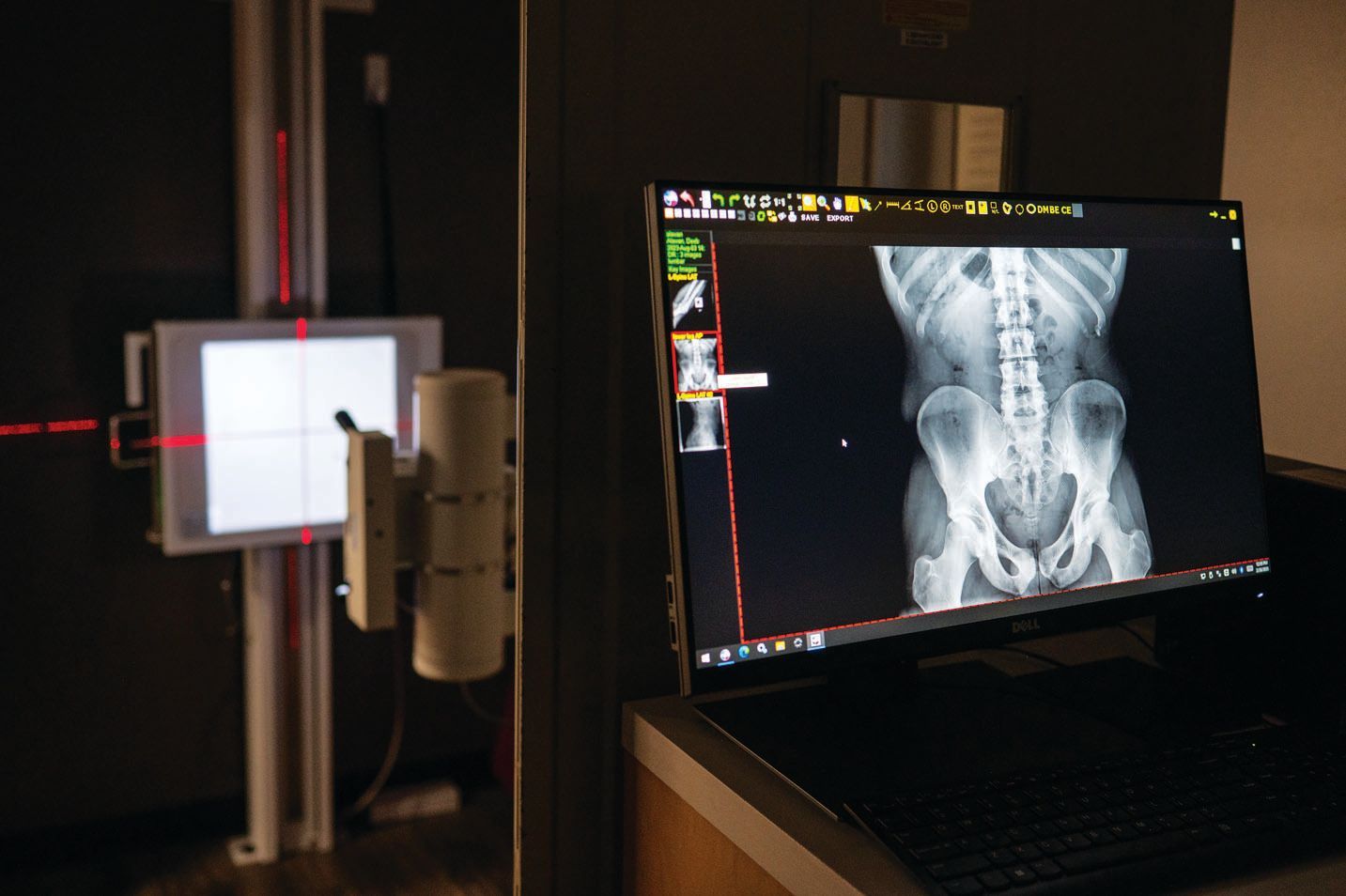 A digital X-ray screen displays a patient's abdomen and pelvis next to a medical imaging unit with laser alignment lights.