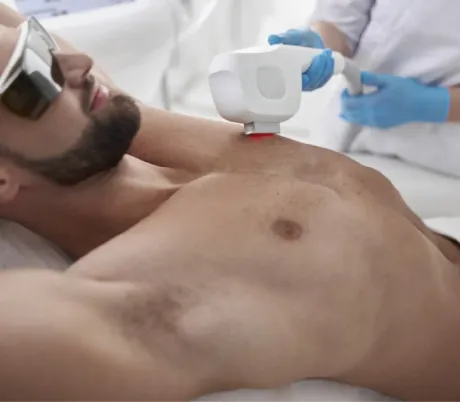 centro estetico laser uomo
