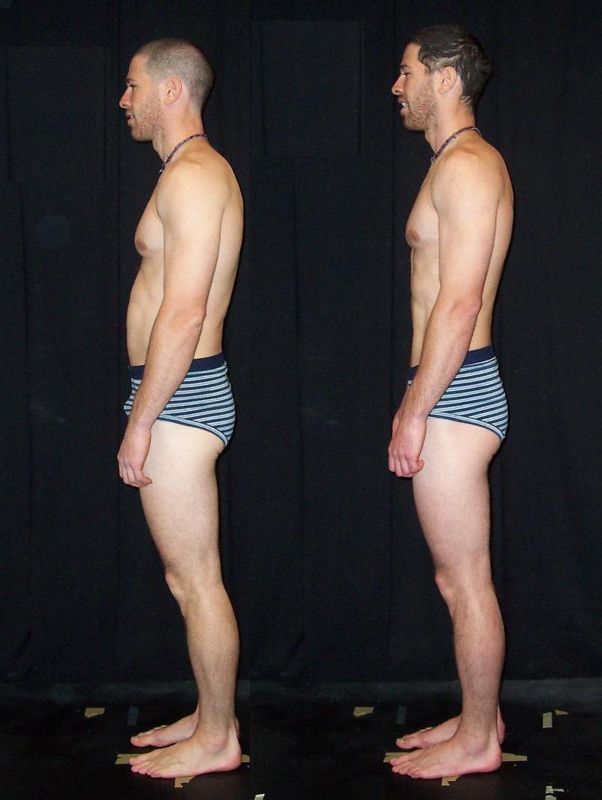 Side before and after