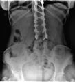 Doctor in mask and blue gloves pointing at an X-ray of a spine