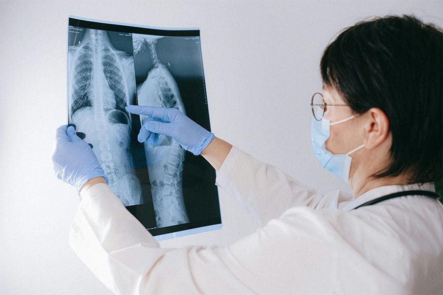 Doctor in mask and gloves pointing at a chest X-ray on a lightbox