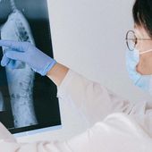 Doctor pointing at a spine X-ray while wearing a mask and blue gloves