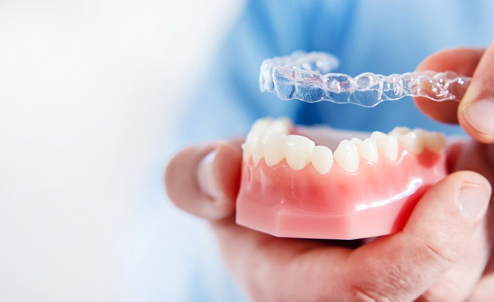 Can You Kiss with Invisalign