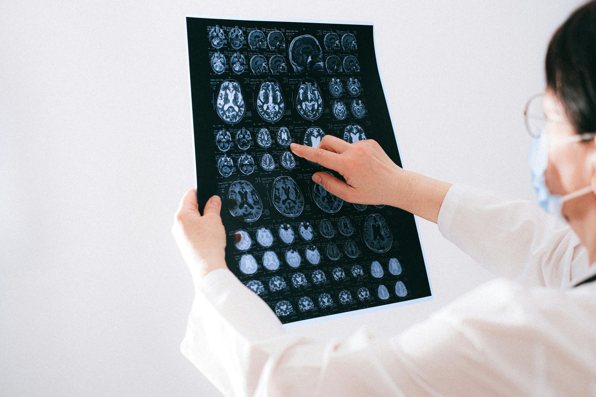 Doctor examining a brain scan film, pointing at multiple MRI images in a clinical setting