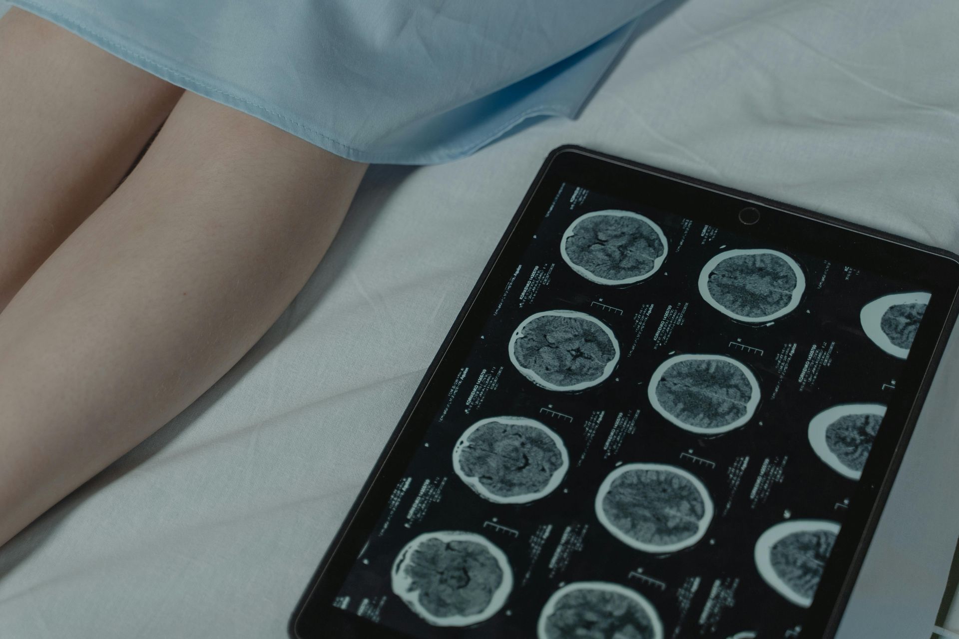 Person lying on a bed beside a tablet displaying brain scan images