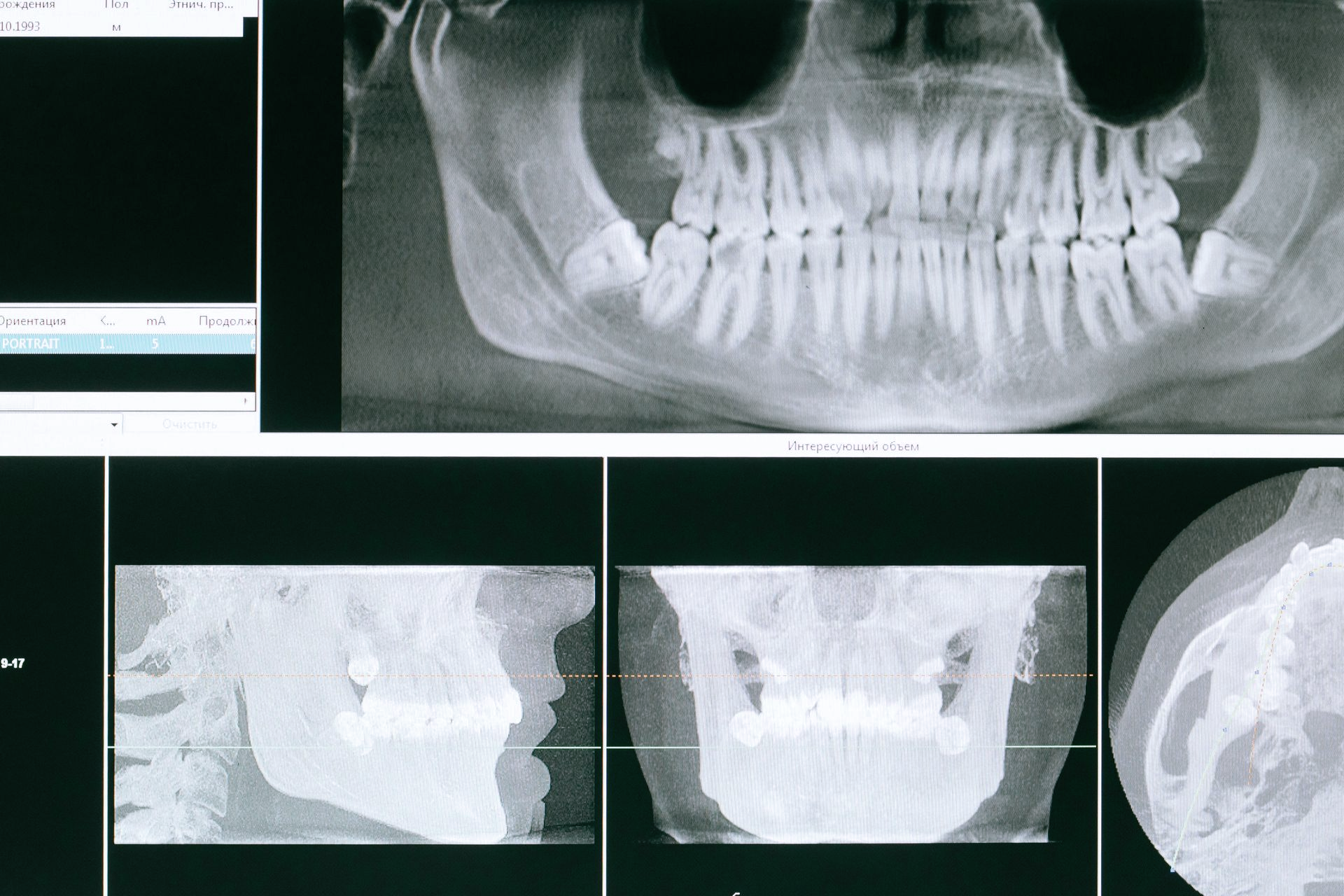 X-Ray images