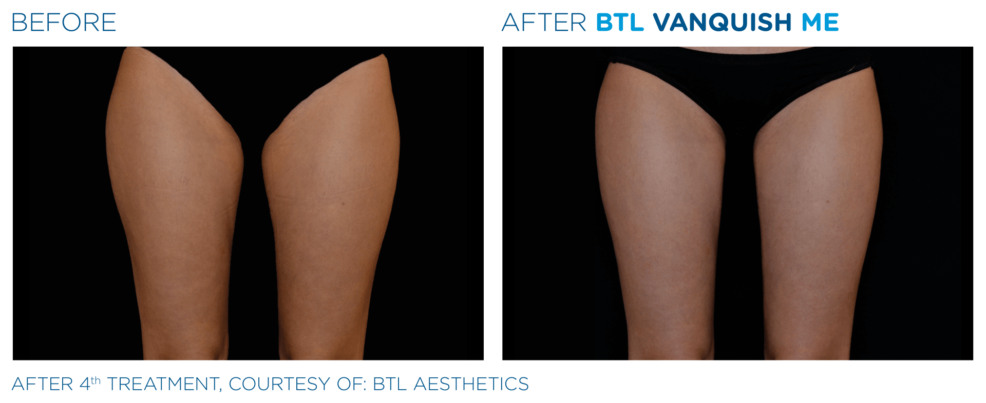 A before and after picture of a woman 's legs with the words 