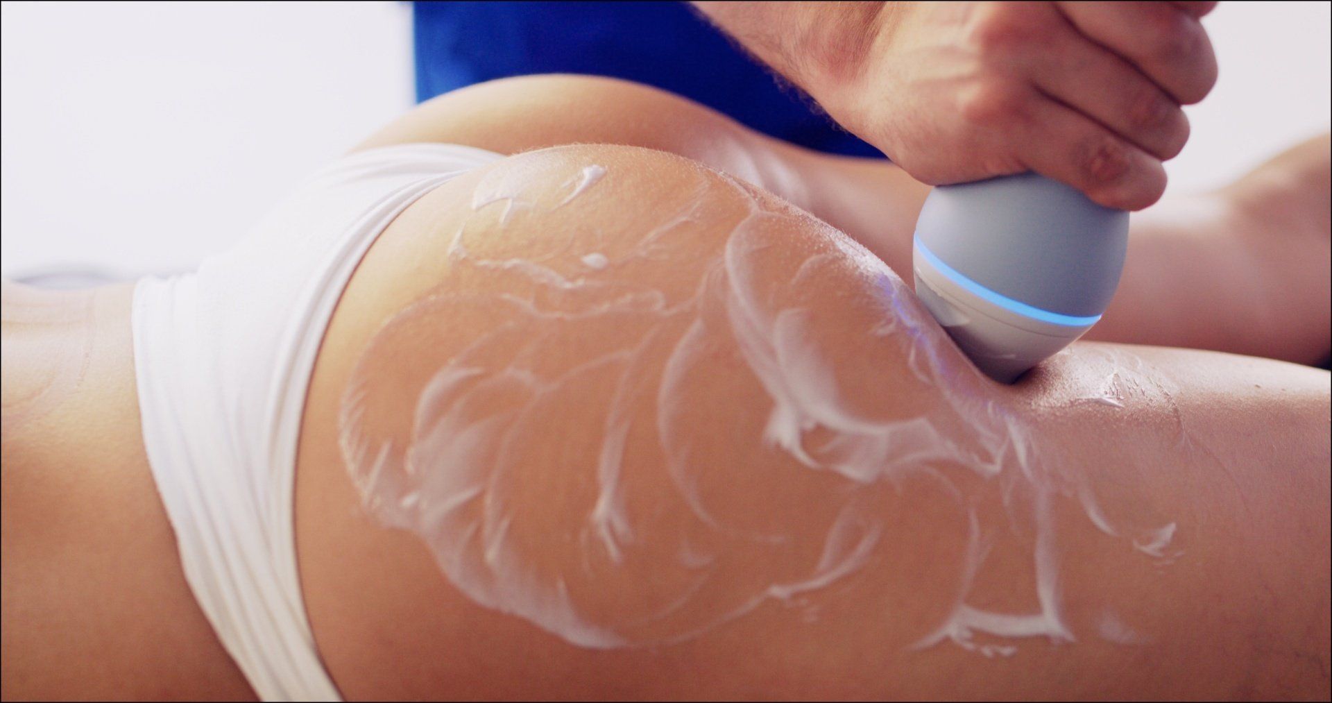 Skin tightening procedure on buttocks