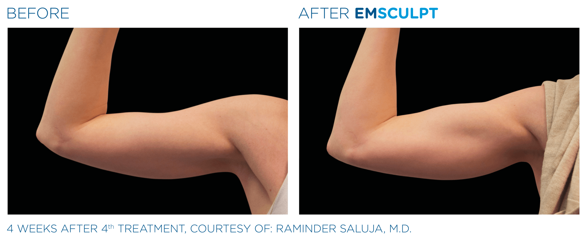 A before and after picture of a woman 's arm.