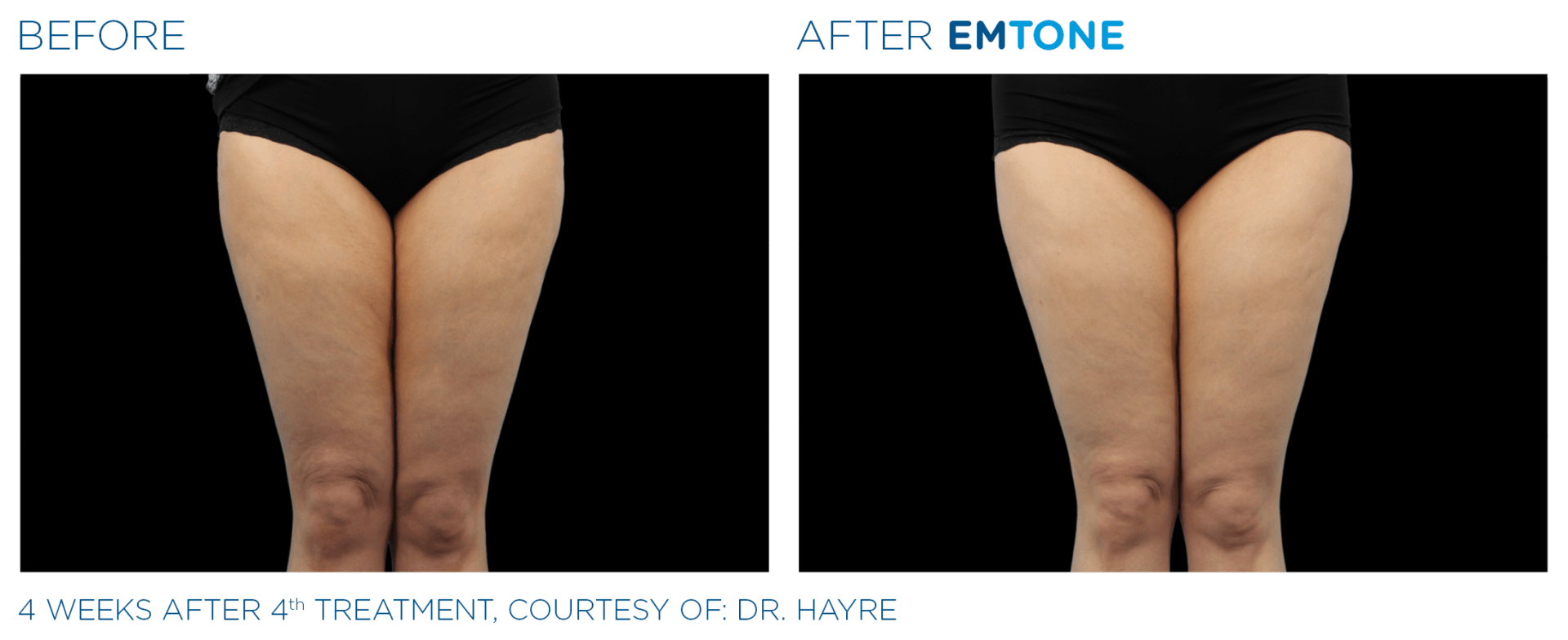 A before and after photo of a woman 's legs with the words 