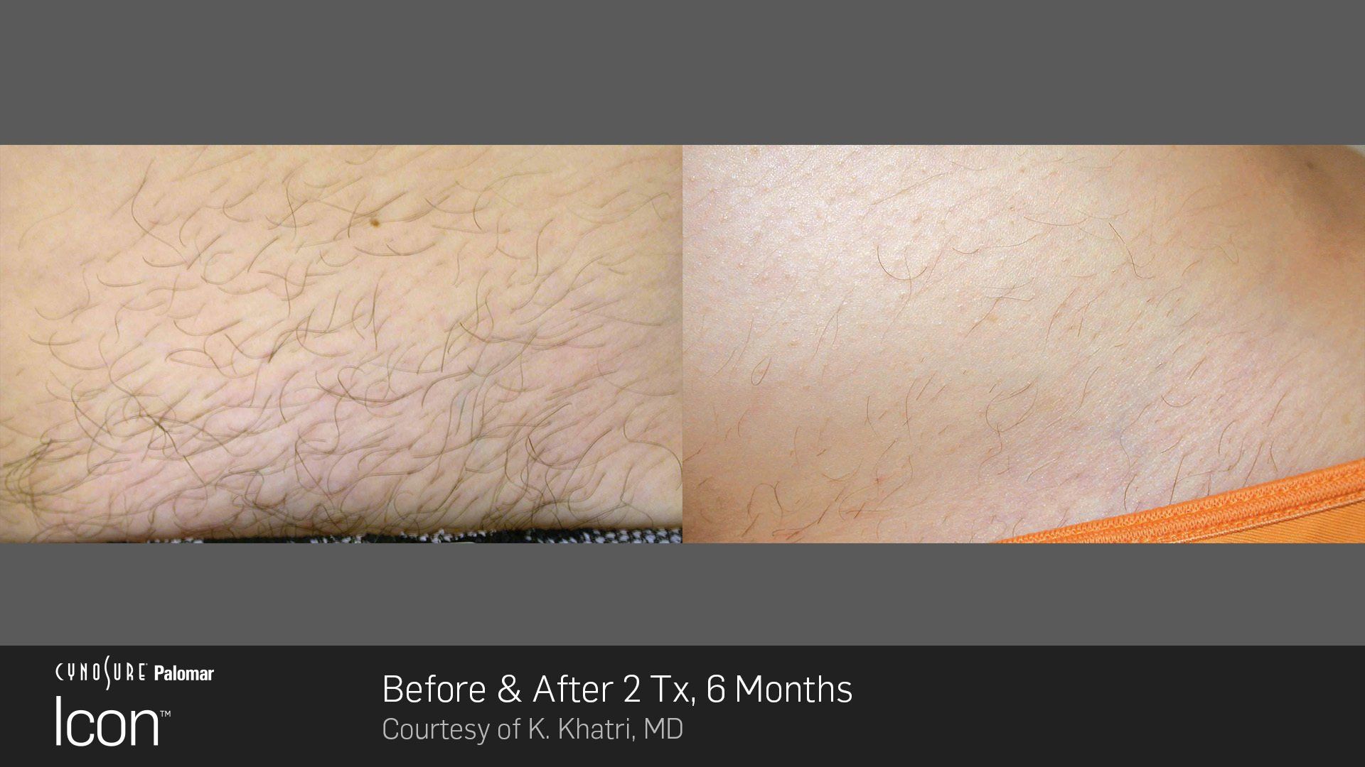 A before and after photo of a person 's hair