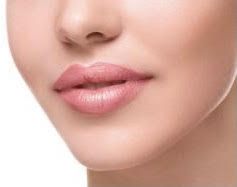 female patient after lip flip procedure