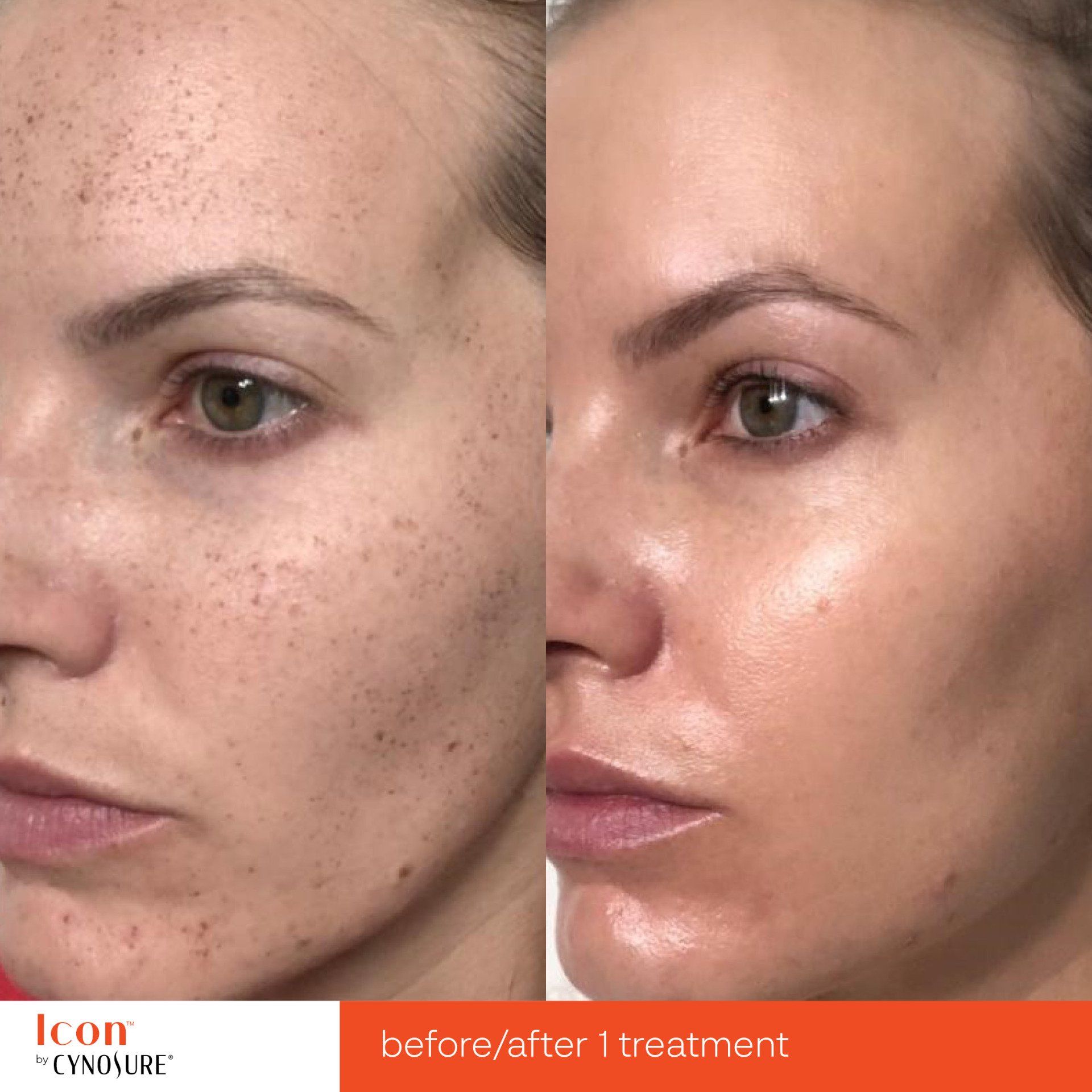 A before and after photo of a woman 's face