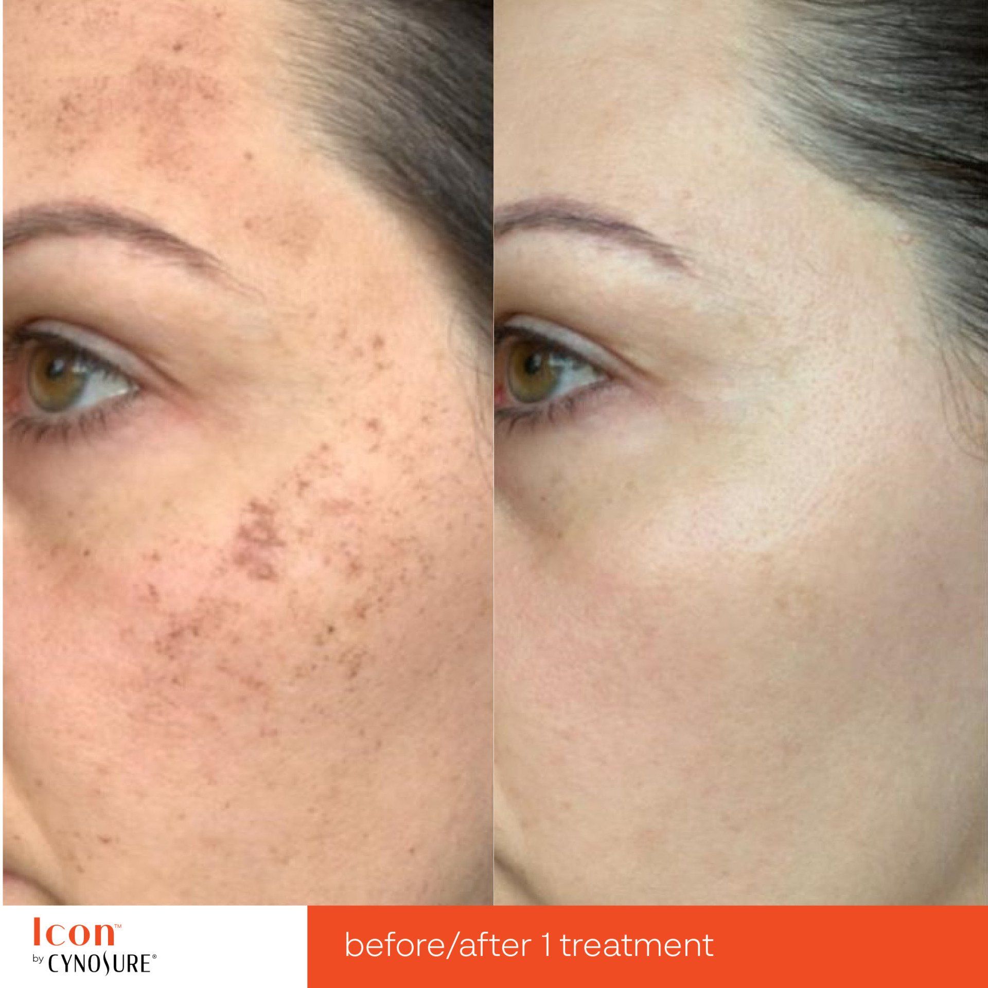 A before and after photo of a woman 's face