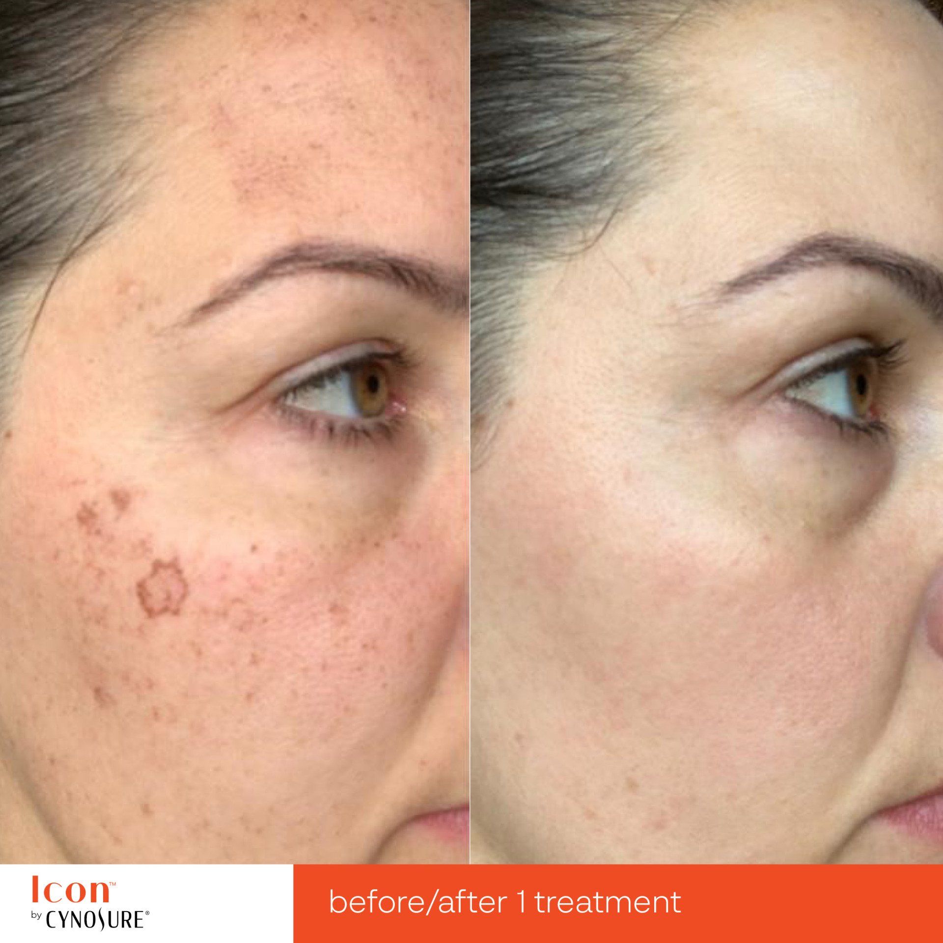 A before and after photo of a woman 's face