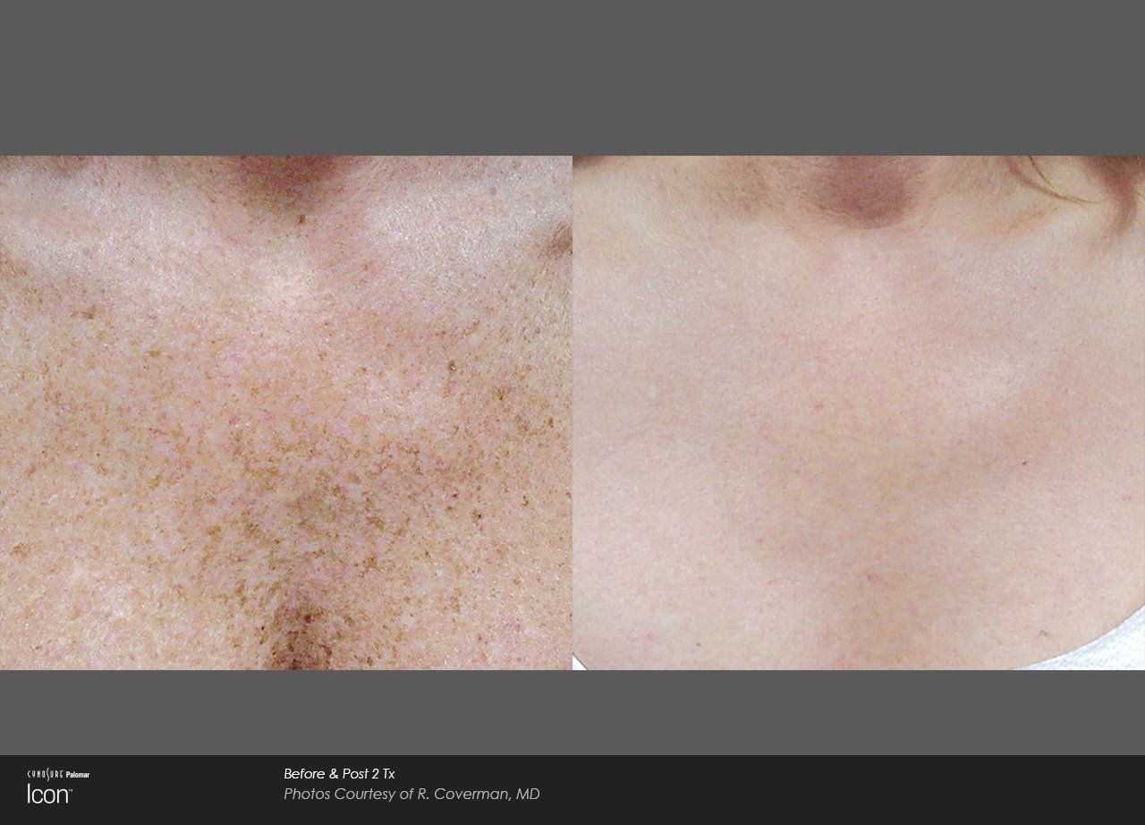 A before and after photo of a person 's face