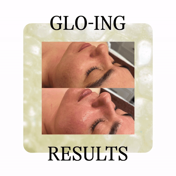 Before-and-after close-up of a glowing facial skin treatment with GLO-ING RESULTS text