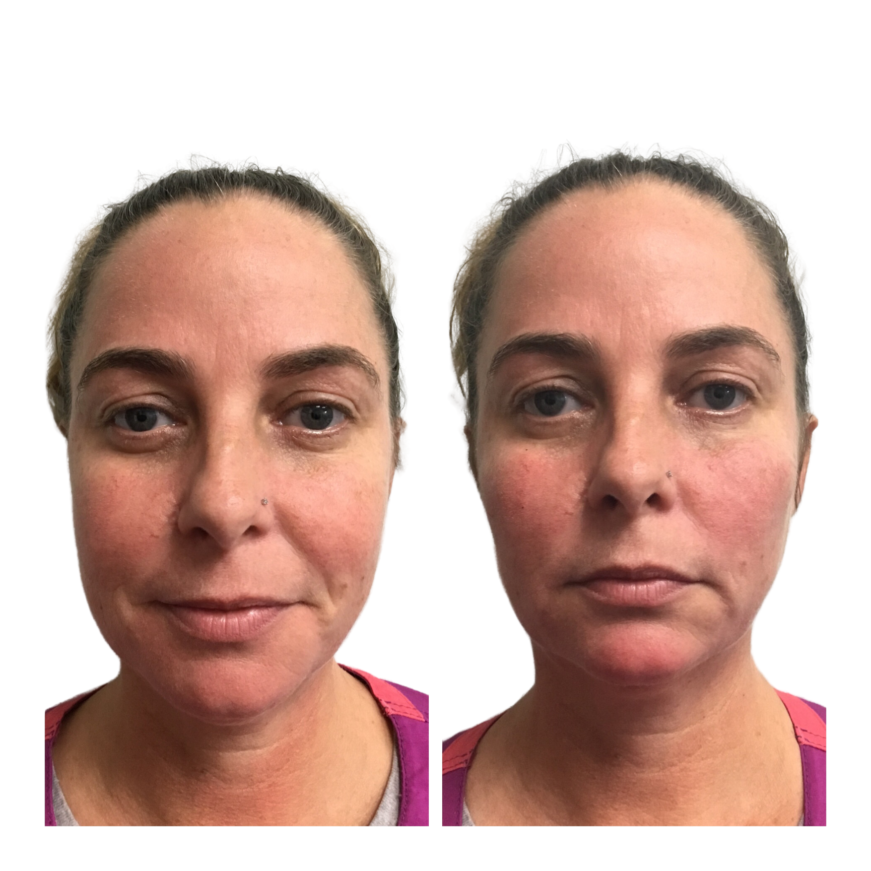 A before and after photo of a woman 's face