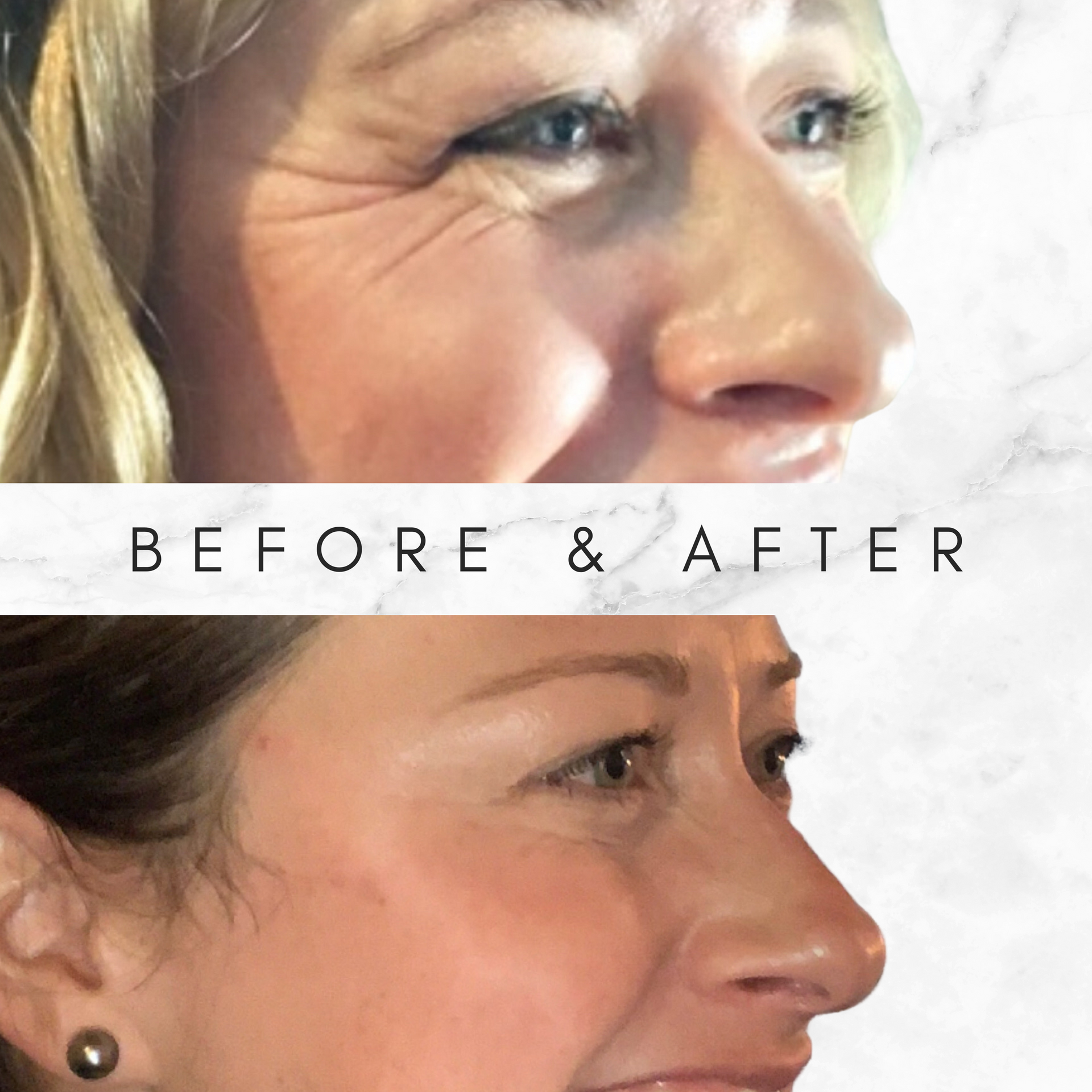 A before and after photo of a woman 's face